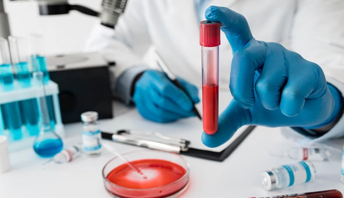 lym-dusuklugu-003 Lym Düşüklüğü