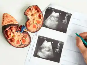 Böbrek Kanseri Uygulamaları