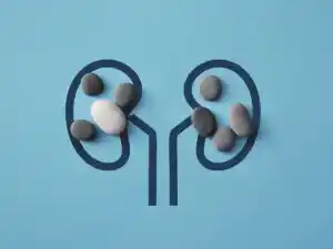 Böbrek Taşları